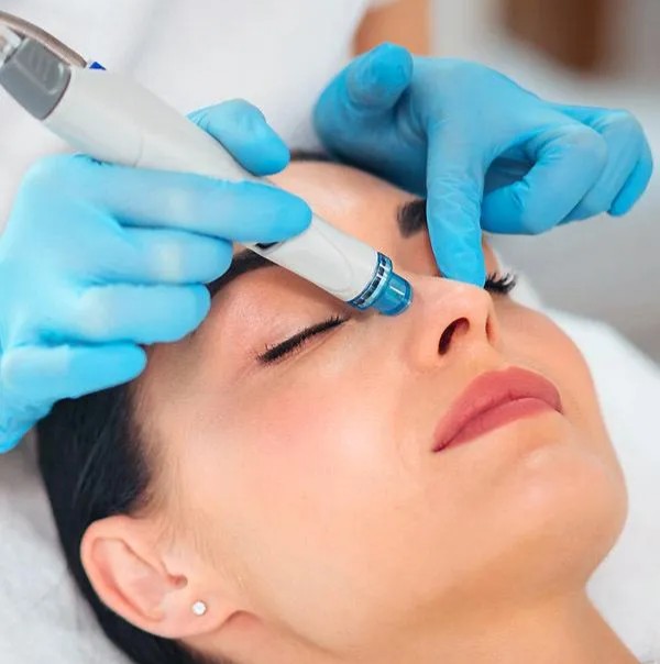 Microneedling hydration treatment